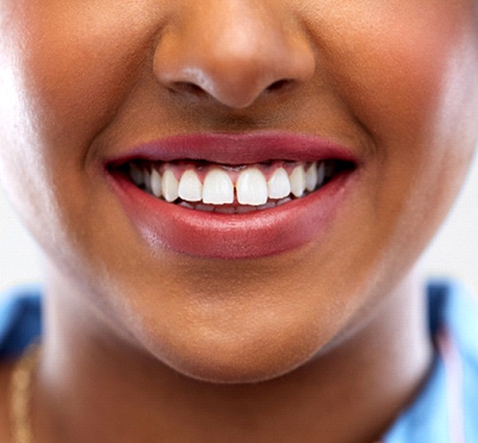 A young woman with a gap between her teeth
