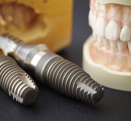 close shot of dental implants in Westport