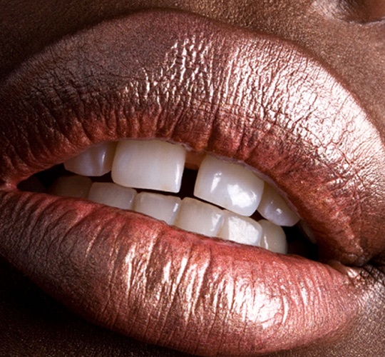 An up-close image of a person’s upper front two teeth that are gapped