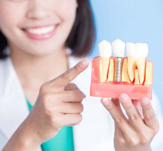 Dentist using model to explain cost of dental implants in Westport