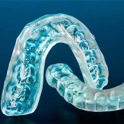 Pair of mouthguards designed to protect teeth
