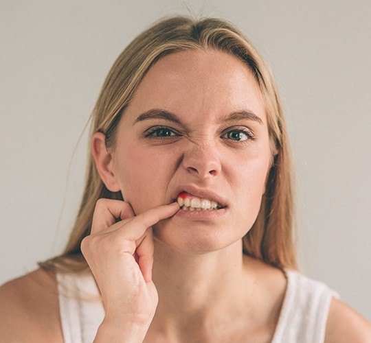 woman with red gums