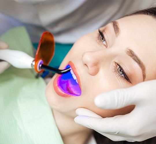 woman getting dental sealants