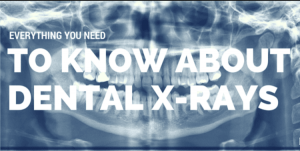 Why are x-rays important to your dentist in Westport?