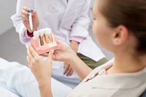 Woman in dentist's chair holding model of dental implants while the dentist points at it with a pen